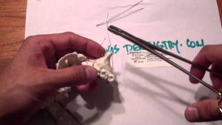 Mandible Fracture  Ivy Loop Fixation  Maxilla Kitchen TableMP4 [upl. by Iseabal657]