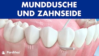 Munddusche und Zahnseide ImplantatPflege © [upl. by Jos]