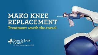 Full Knee Replacment  Mako Robotic Arm Assisted Surgery Technology [upl. by Tilford]