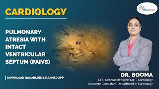 Cardiology  Pulmonary atresia with intact ventricular septum PAIVS  Raaonline [upl. by Harbert]