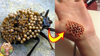 Faites ATTENTION Aux Piqures de Ces Insectes [upl. by Atikal]