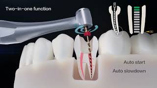 High Quality Woodpecker Endo Motor Endo Radar Plus With Build In Apex Locator [upl. by Cordova]