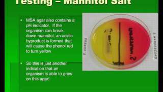 Introduction to Streptococcus [upl. by Bonney329]