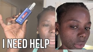 What L’ORÉAL Retinol Night Serum Dose To My Face  I Need Help lorealparis lorealcosmetics [upl. by Tnomyar]