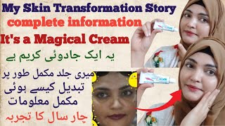 How To Use Tretinoin SkinA Retinoid Cream My Skin Transformation With Tretinoin SkinA Retinoid [upl. by Pillsbury793]