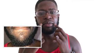 Growing a Beard With Minoxidil A Black Mans Experience Week 48 [upl. by Aitital540]