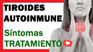 Tiroides Autoinmune o Tiroiditis de Hashimoto SINTOMAS y TRATAMIENTO ✅ [upl. by Ylrebmic]