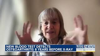 Newlysurfaced blood test detects osteoarthritis years before Xray [upl. by Frolick157]