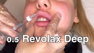 Russian Lips With Revolax Deep 11 ml only 05 [upl. by Art]