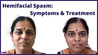 Hemifacial spasms symptoms and treatment Dr Jaydev Panchwagh [upl. by Inafit]