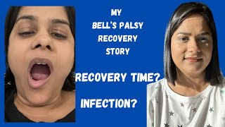 How I Recovered From Bells Palsy  Facial Paralysis [upl. by Muriel]