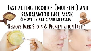 quotBest Natural Remedies to Remove Melasma Freckles Dark Spots and Hyperpigmentation Fastquot [upl. by Gannes]