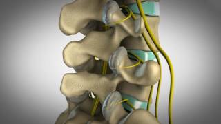 Orlando Chiropractic  Custom 3D animation visualizing facet syndrome and how chiropractic can help [upl. by Cyrilla122]