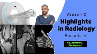 Highlights in Radiology S2 E6 anterior cruciate ligament tear [upl. by Guinn6]