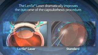 Contact Lens Tips for Beginners  Eye Doctor Explains [upl. by Aicirtap]