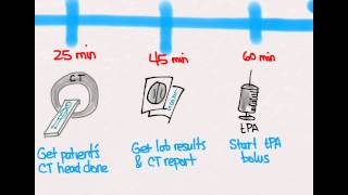 Ischemic Stroke 04 Treatment with tPA [upl. by Alios72]