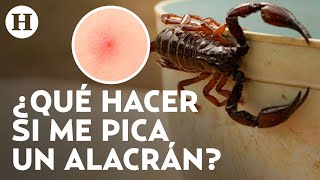 ¡Temporada de alacranes en México Esto debes hacer en caso de ser picado por uno de estos animales [upl. by Lovell718]