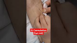 IV Cannulation  Part 442  ICU shorts viral doctor paramedical youtubeshorts [upl. by Zoha999]