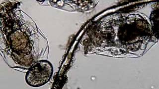 Rotifers under microscope [upl. by Anert]