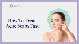 How to Heal Acne Scabs Fast and Easy with Dr Leslie Baumann [upl. by Eamaj]