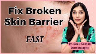 Fix Your Broken Skin Barrier Fast Proven Dermatologist Secrets [upl. by Pickens]