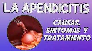 LA APENDICITIS Causas síntomas diagnóstico y tratamiento [upl. by O'Callaghan213]