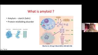 Diagnostic de la cardiomyopathie amyloide transthyrétine  N Doghmi Rabat [upl. by Andi]