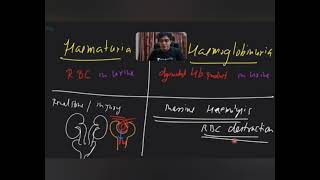 Difference Between Hematuria amp Hemoglobinuria [upl. by Enoed912]