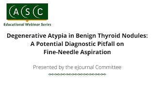 Degenerative Atypia in Benign Thyroid Nodules A Potential Diagnostic Pitfall on [upl. by Zolner]