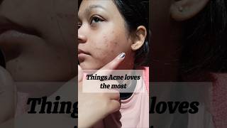 Reason of Acne shorts skin acnescars acne acnepositivity skincare trending [upl. by Lamej]