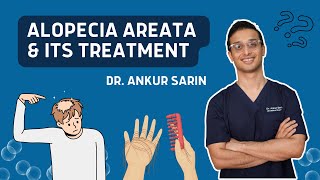 Alopecia Areata Treatment  Injections natural remedies treatment in Hindi  Dr Ankur Sarin [upl. by Ennaeilsel944]