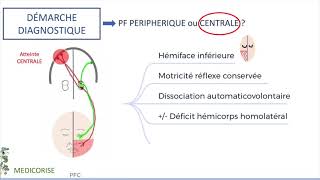 Nerf facial et paralysie faciale périphérique  ECN amp FMC  Anatomie [upl. by Novah4]