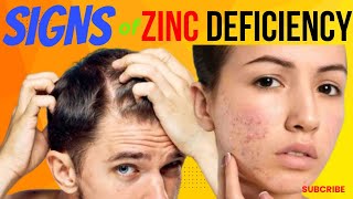 20 Signs and Symptoms of Zinc Deficiency [upl. by Edwards464]