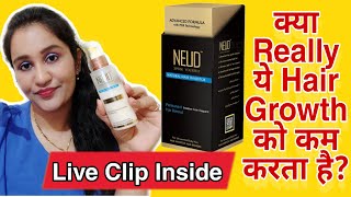 Neud Hair Inhibitor Review  My Experience With Neud Hair Inhibitor  Non Sponsored [upl. by Launce]