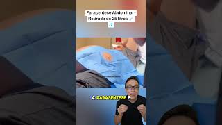 25 Litros de Ascite 😱💉 medicina medico enfermagem tecnicodeenfermagem saude barriga dágua [upl. by Atinad]