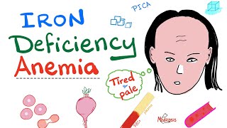 Iron Deficiency Anemia  All you need to know  Causes Symptoms Diagnosis Treatment [upl. by Anaik]