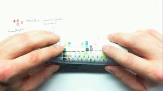 Urinalysis Part 3mp4 [upl. by Eirrahs151]