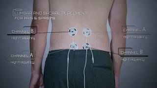 Lumbar and Sacral Placement for Pain and Back Issues Example [upl. by Ilhsa]