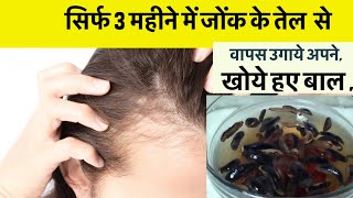 3 maheene me baal ugao jonk oil se  jonk oil se kya hota hai  jonk oil for hair regrowth [upl. by Nylegna57]