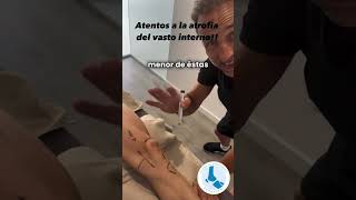 Lesiones de Rodilla Clave del Vasto Interno en la Recuperación y Prevención fyp viral parati [upl. by Ahsiyt]