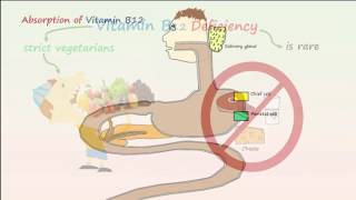 Megaloblastic Anemia Part 1 Vitamin B12 Deficiency Anemia [upl. by Yeo]