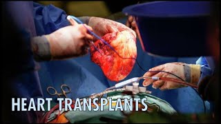 The Journey of Heart Transplants From Discovery to Procedure [upl. by Uv381]