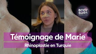 CHIRURGIE ESTHÉTIQUE  🙋🏻‍♀️Témoignage de Marie pour une Rhinoplastie en Turquie  BODYEXPERT [upl. by Anthea]