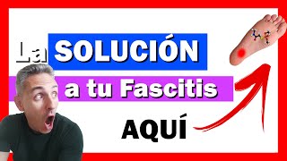 👉TODO lo NECESARIO para Eliminar la FASCITIS Plantar [upl. by Rebmat960]