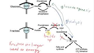 Hereditary Fructose Intolerance HFI [upl. by Nohsal]