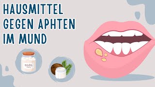 10 Natürliche Hausmittel gegen Aphten im Mund [upl. by Ainel]