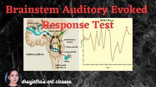 210Brainstem Evoked Response Audiometry BERA Part 22 bera oae screening [upl. by Anotyad]