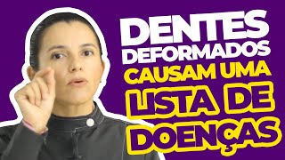 Dentes deformados podem causar uma série de doenças Quais são [upl. by Lasorella]