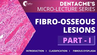 FIBROOSSEOUS LESIONS PARTI by DentAcme neetmdslectures neetmds inicetmds inbde afk adc [upl. by Lseil]