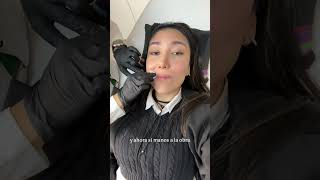 Mejorando mis labios con ácido hialuronico fillers [upl. by Ahk]